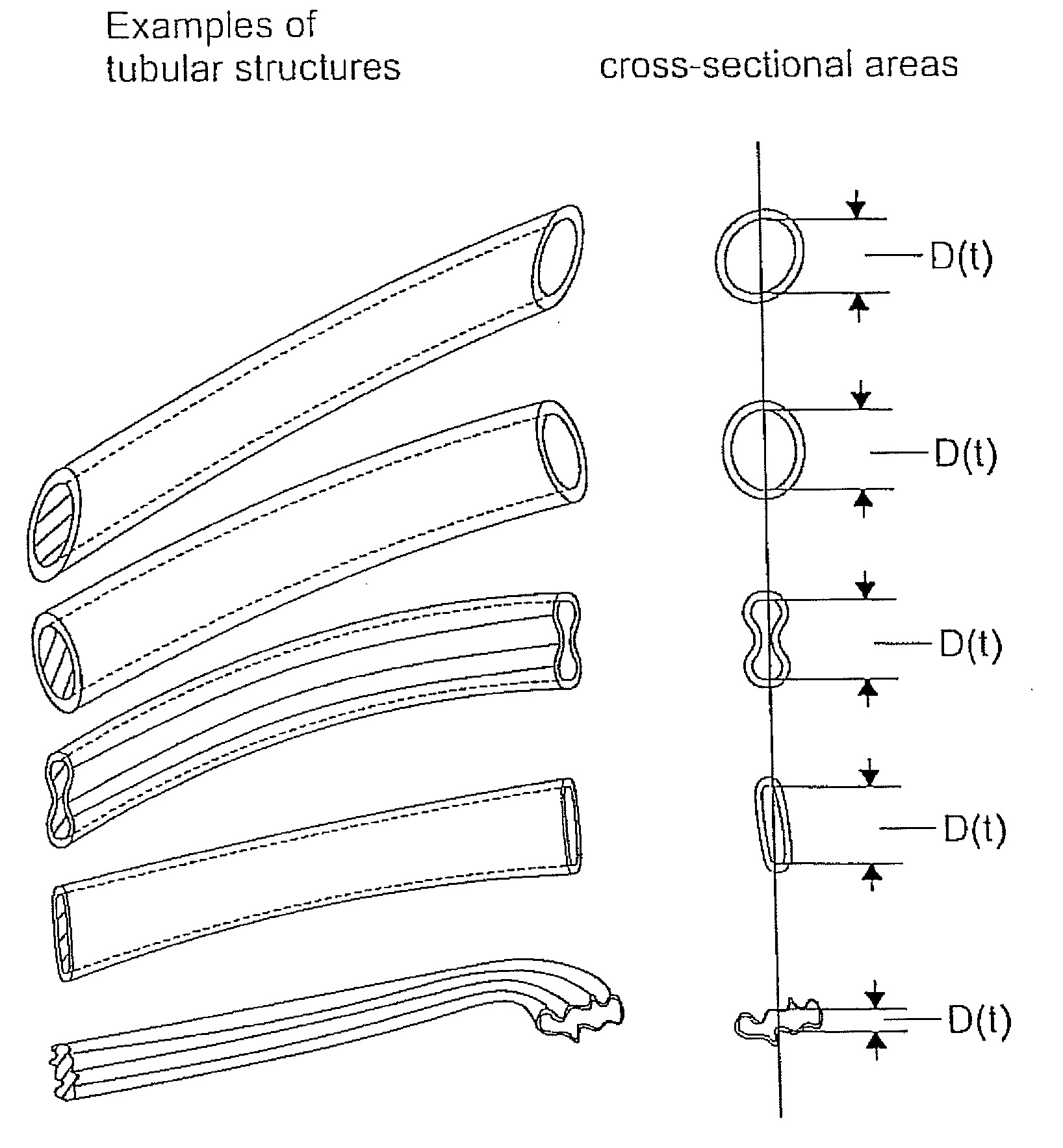 Method of conditioning a hybrid synthetic tubular structure to yeild a functional human hybrid hemodialysis access graft