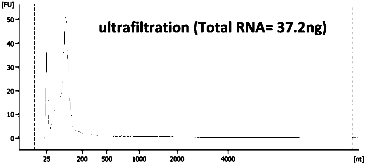 Biomarker for diagnosing bladder cancer and monitoring recurrence and detection kit