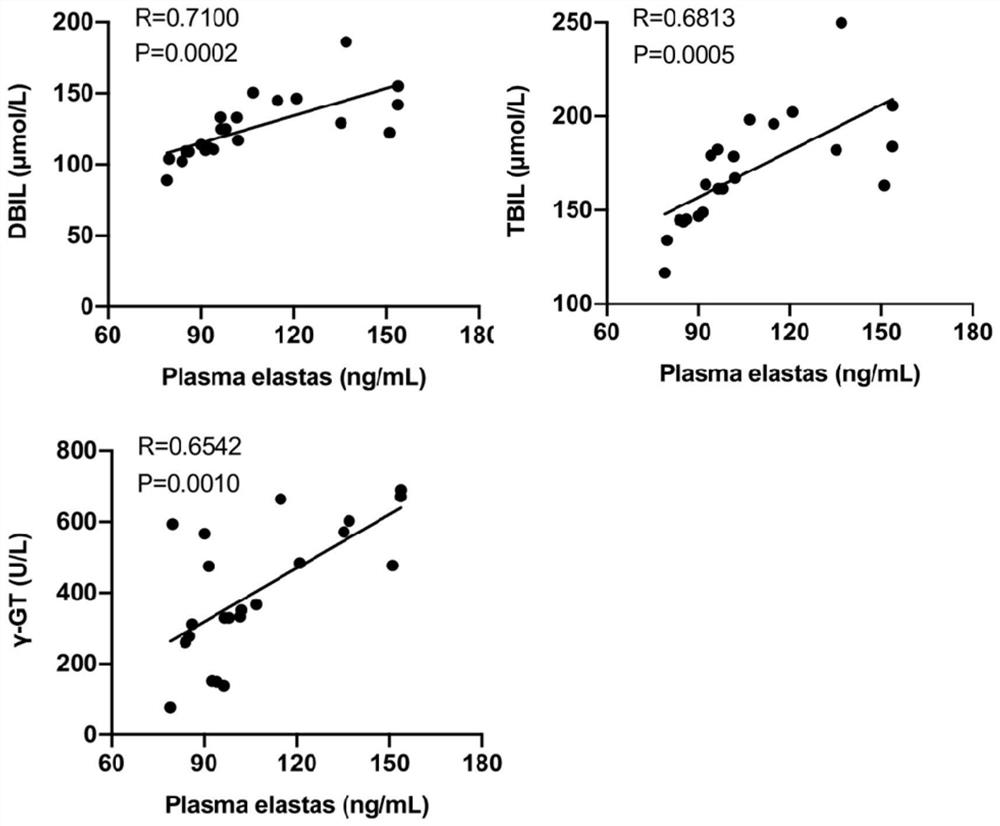 Application of neutrophil elastase in preparation of product for diagnosing biliary atresia