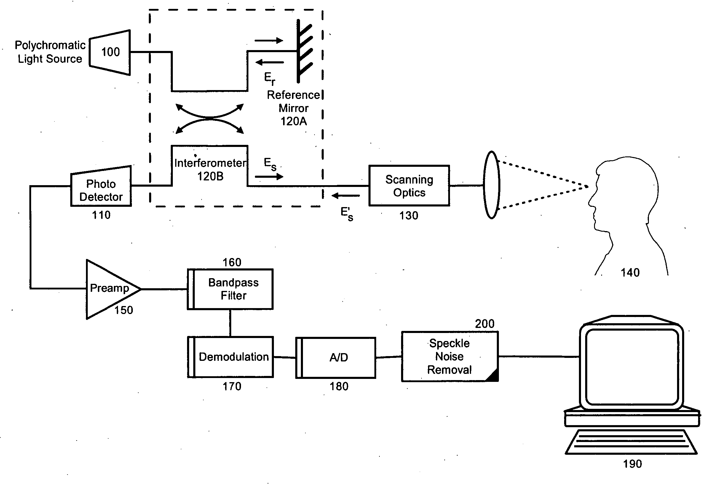 Speckle noise removal in optical coherence tomography