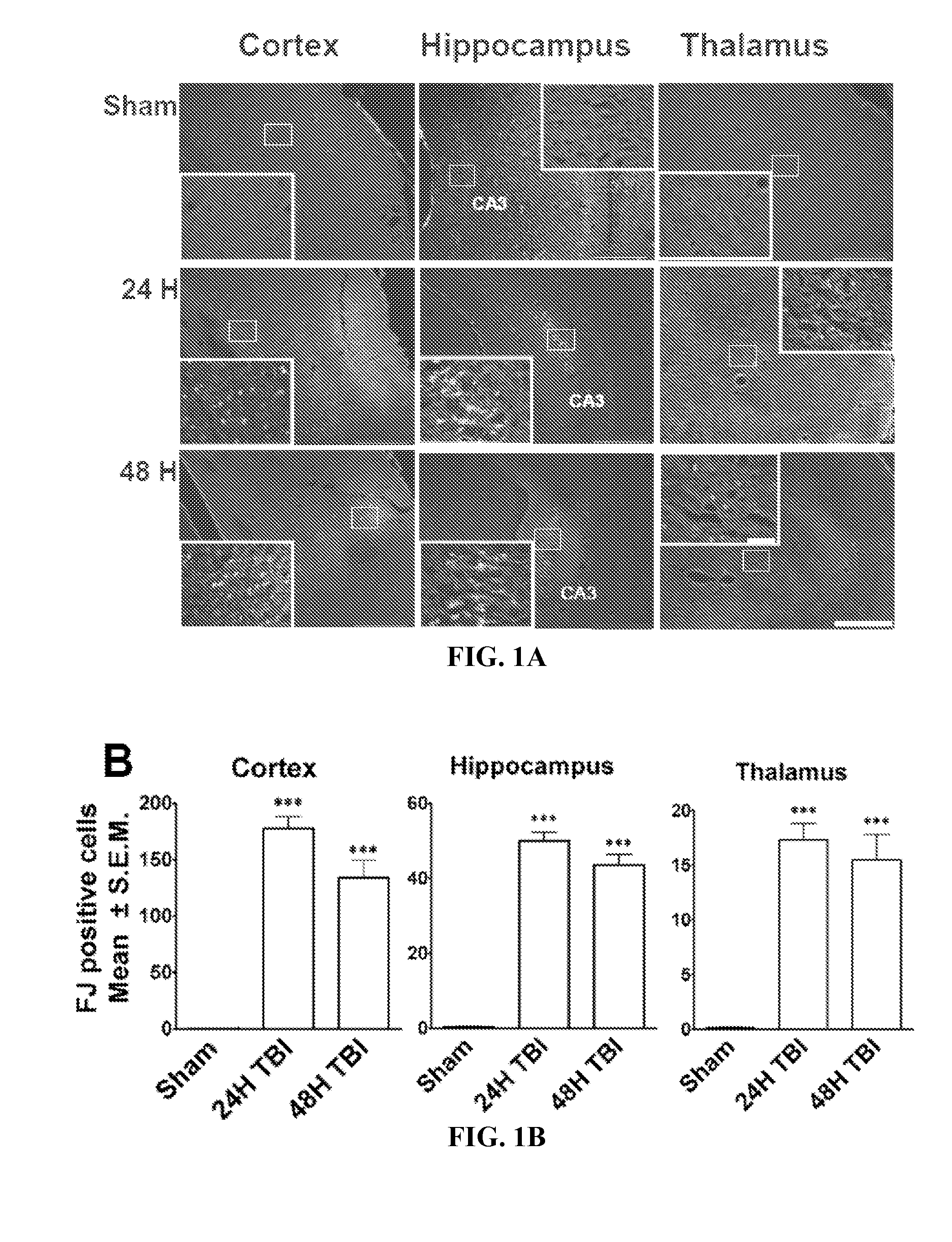 Diagnosis and treatment of traumatic brain injury