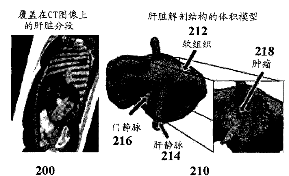 System and method for patient specific modeling of liver tumor ablation