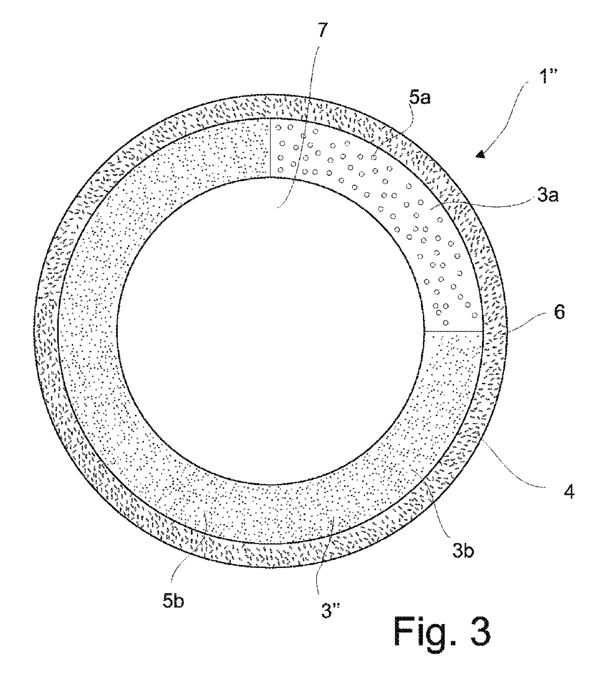 Intrauterine device and method for reducing the rate of diffusion of active ingredients in said device by adding inert particulates to a polymeric coating