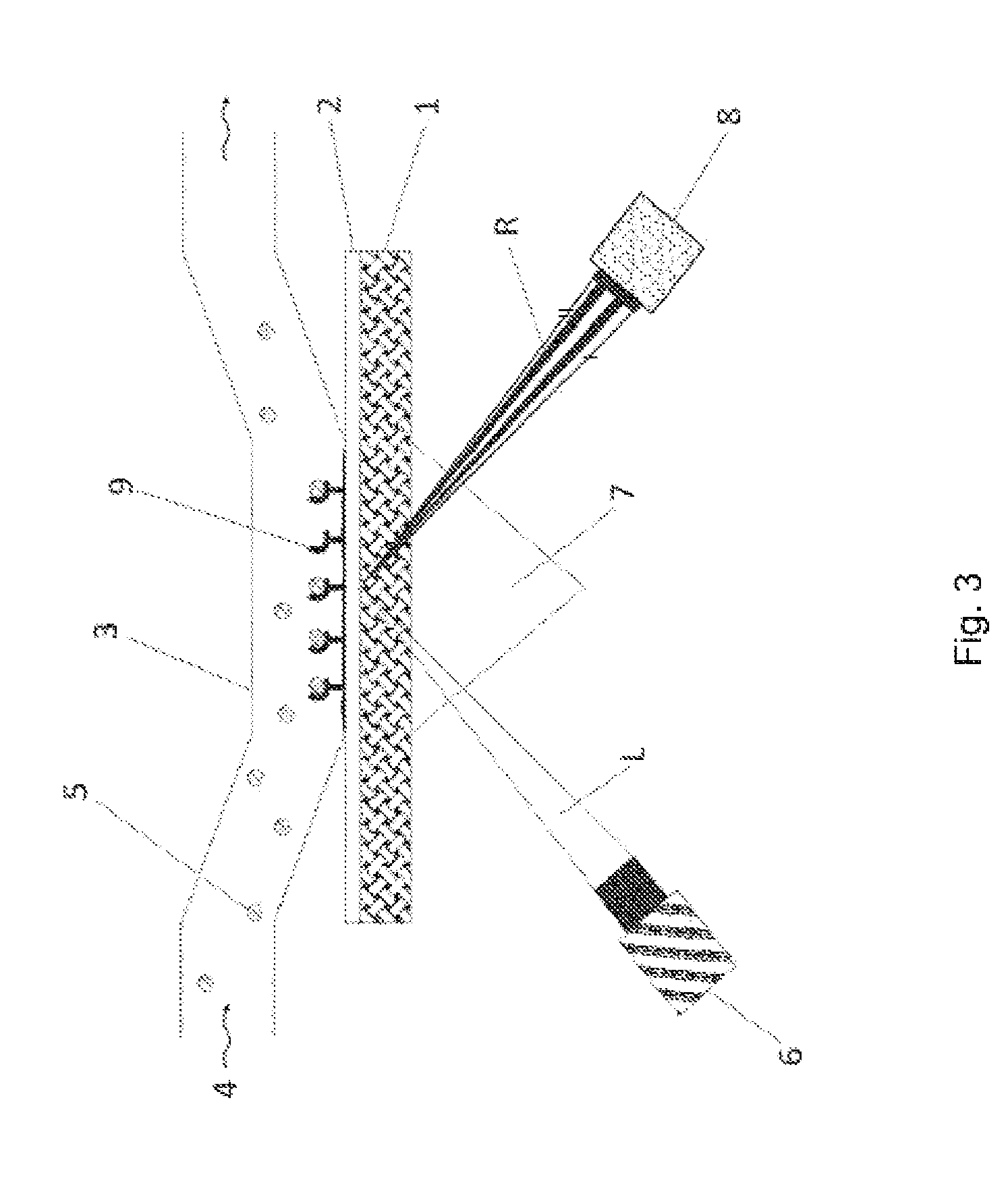 Aptamers that are specific for immunoglobulin-binding cell wall proteins