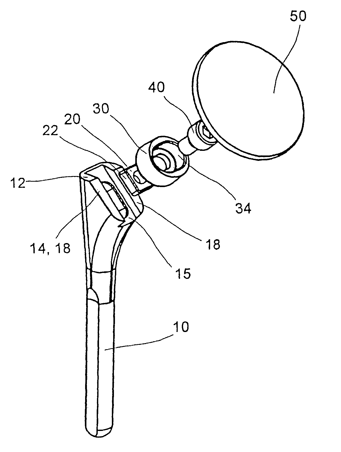 Shoulder prosthesis