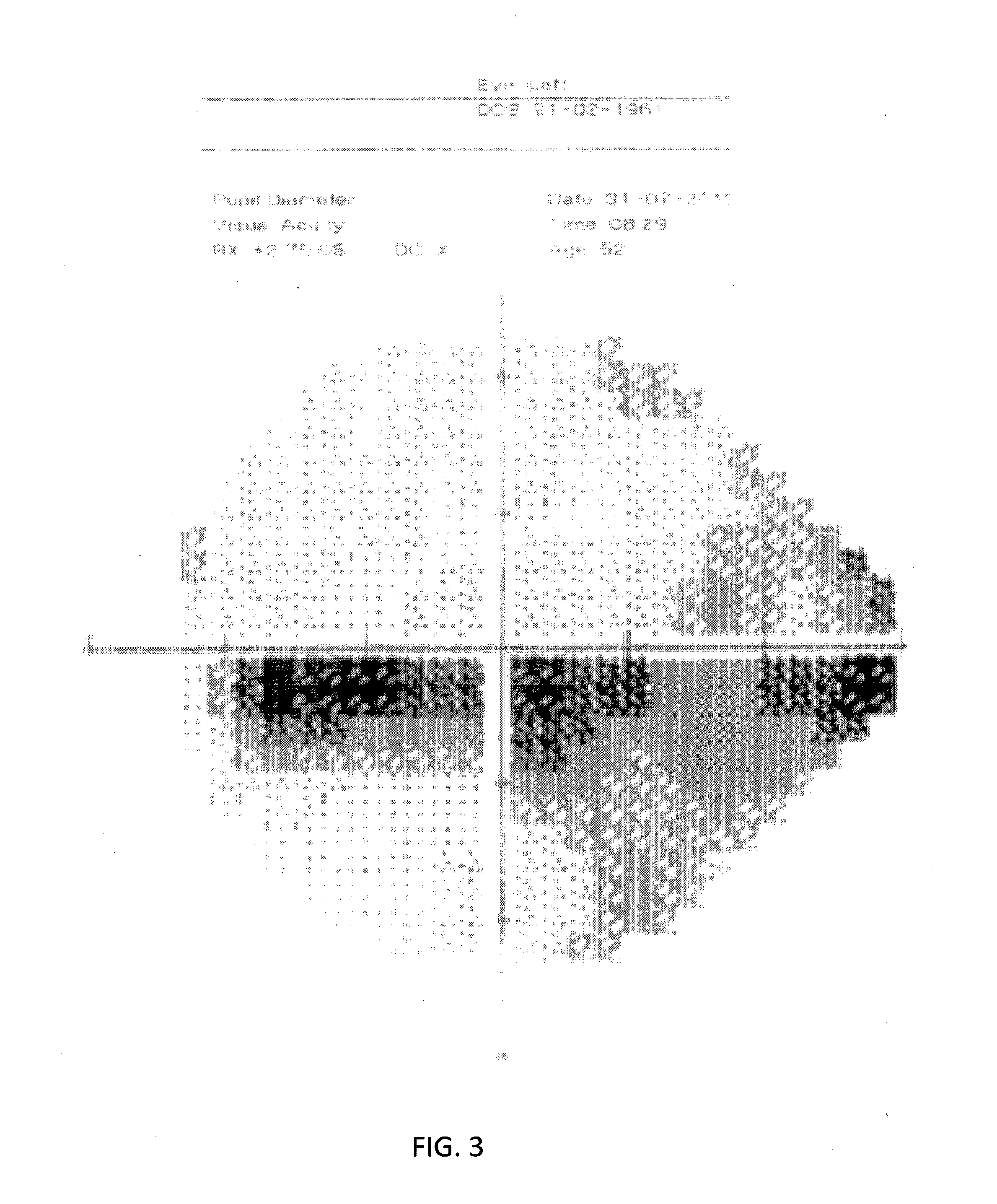 Compositions of omega 3 fatty acids to treat diseases which involve damage to the nervous system