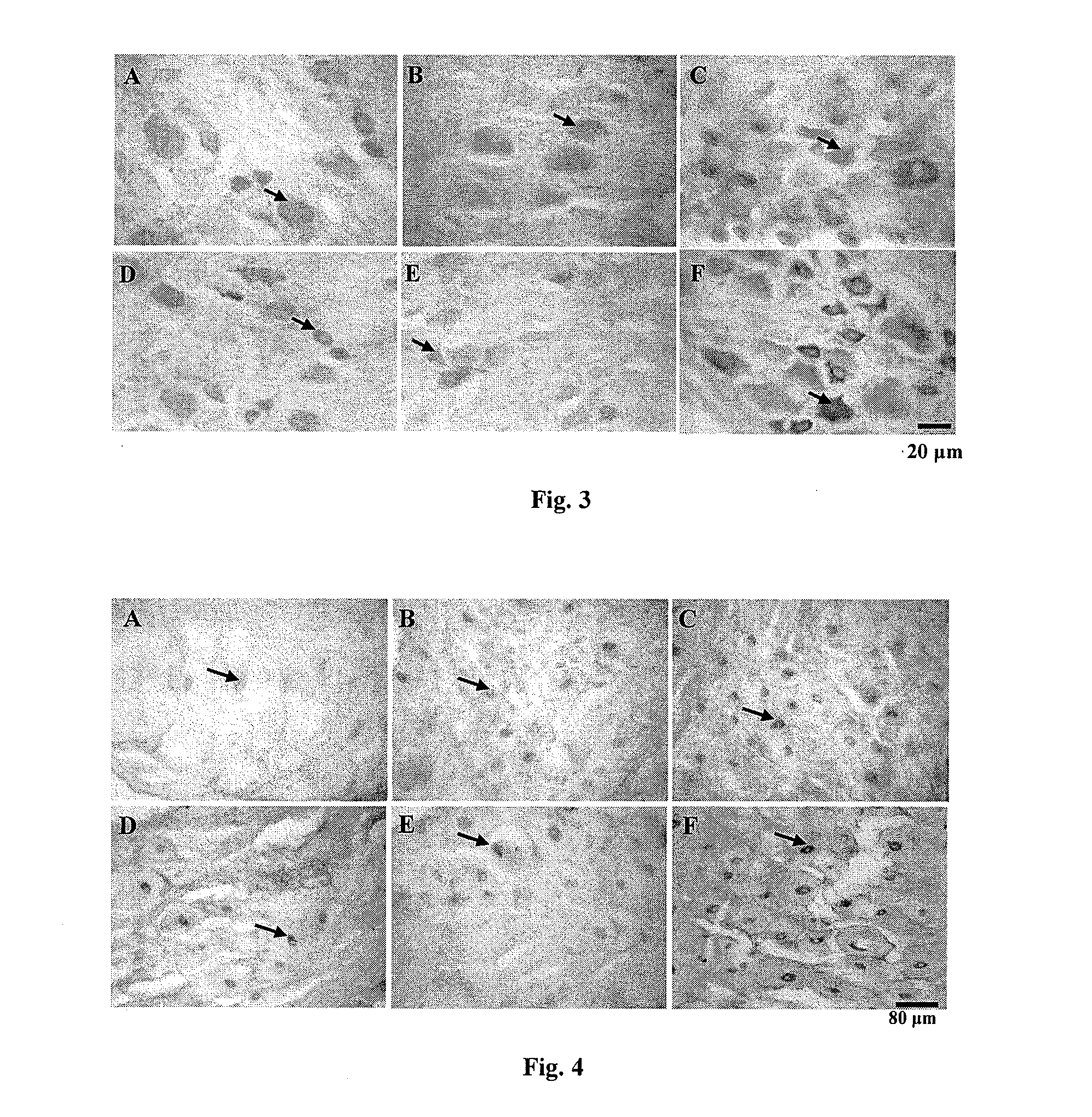 Application of puerarin in the preparation of P2X<sub>3 </sub>mediated drugs for pain/nervous system diseases