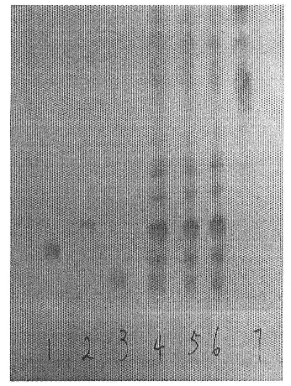 Quality detection method for RuanGanXiaoShui cataplasma