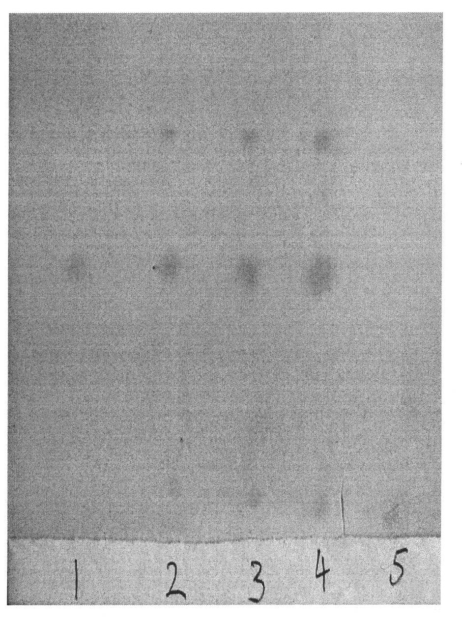 Quality detection method for RuanGanXiaoShui cataplasma