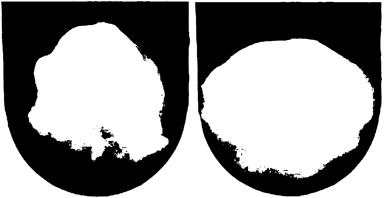 Injectable expanded composite bone cement of bone-imitating trabecula structure and preparation method of injectable expanded composite bone cement