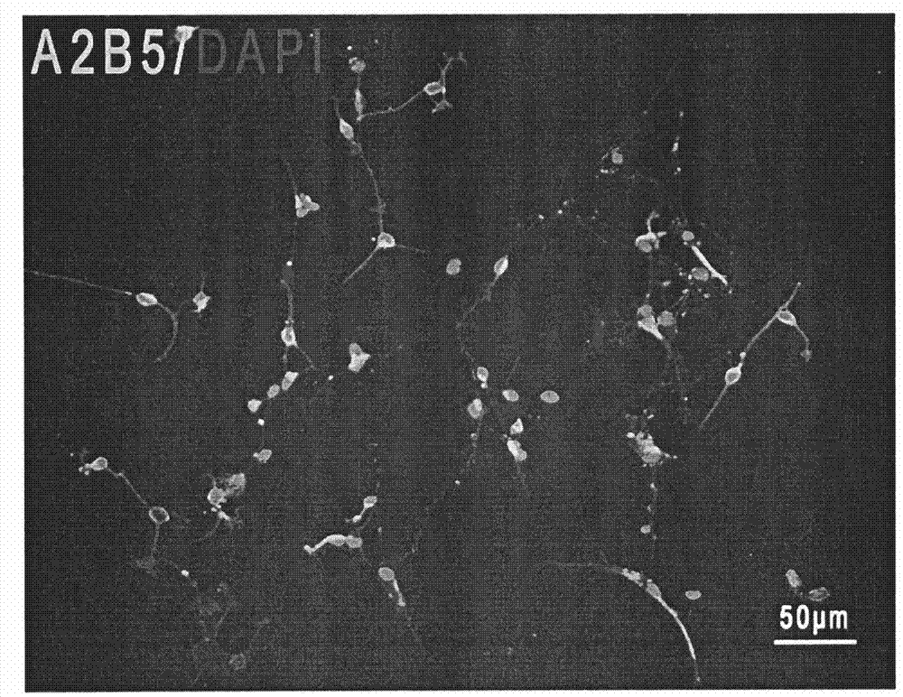 Induction medium for inducing neural stem/progenitor cells to be differentiated into oligodendrocyte precursor cells and induction method and application thereof