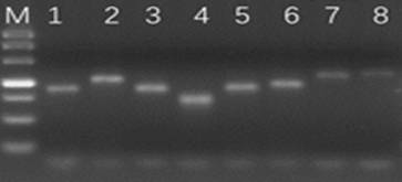 Method for determining minimal residual lesion level based on multiple amplification sequencing