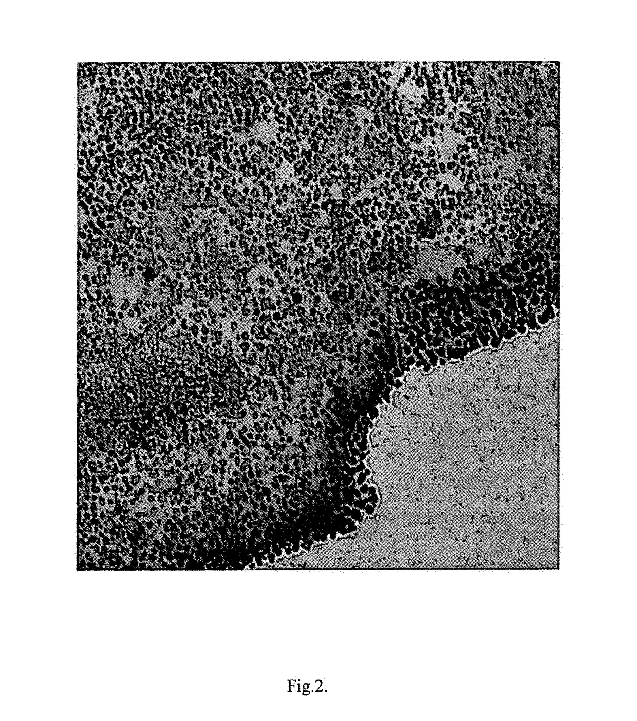 Ordered nano-porous carbon coating on silicon or silicon/graphene composites as lithium ion battery anode materials