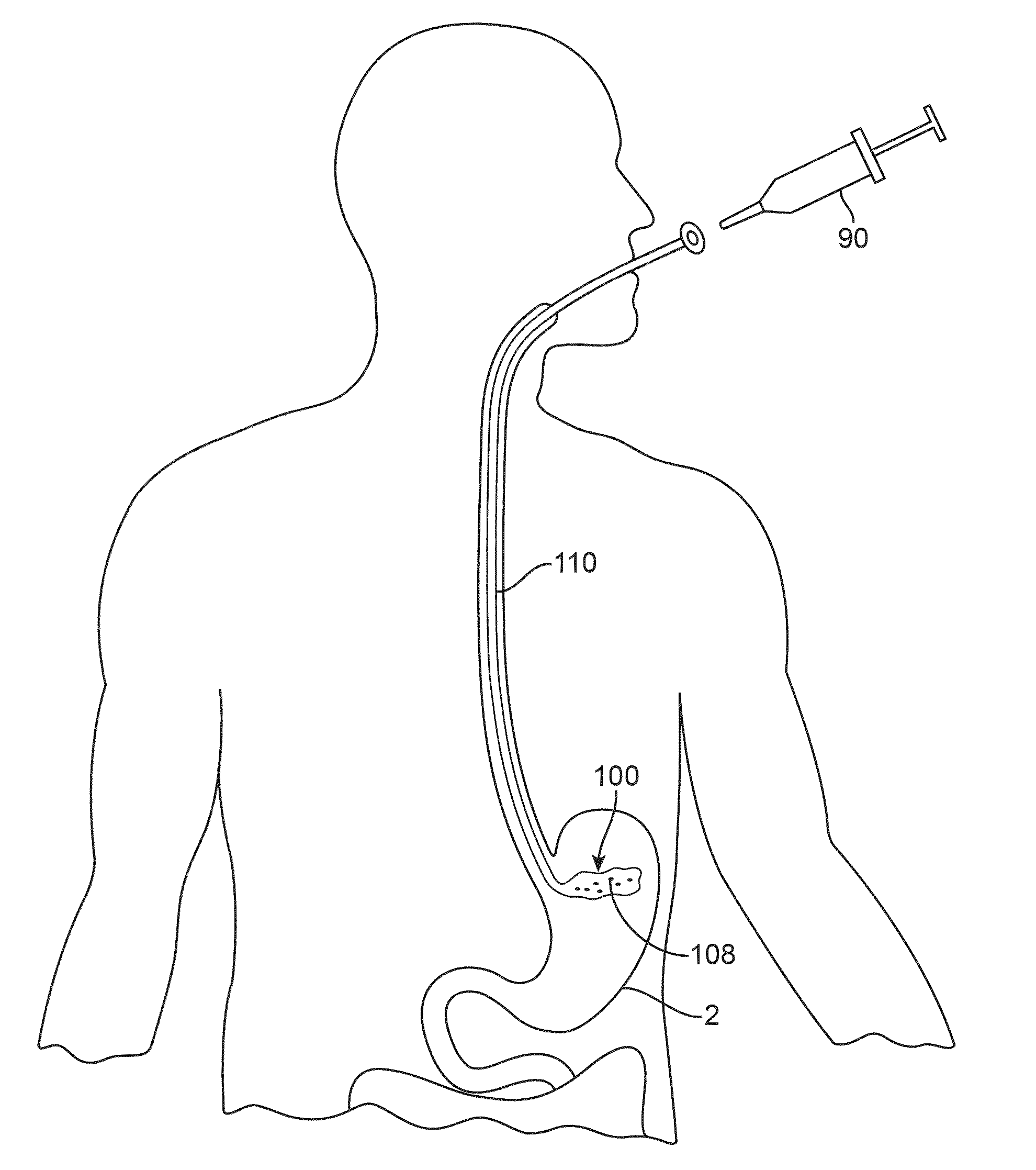 Anatomically adapted ingestible delivery systems and methods