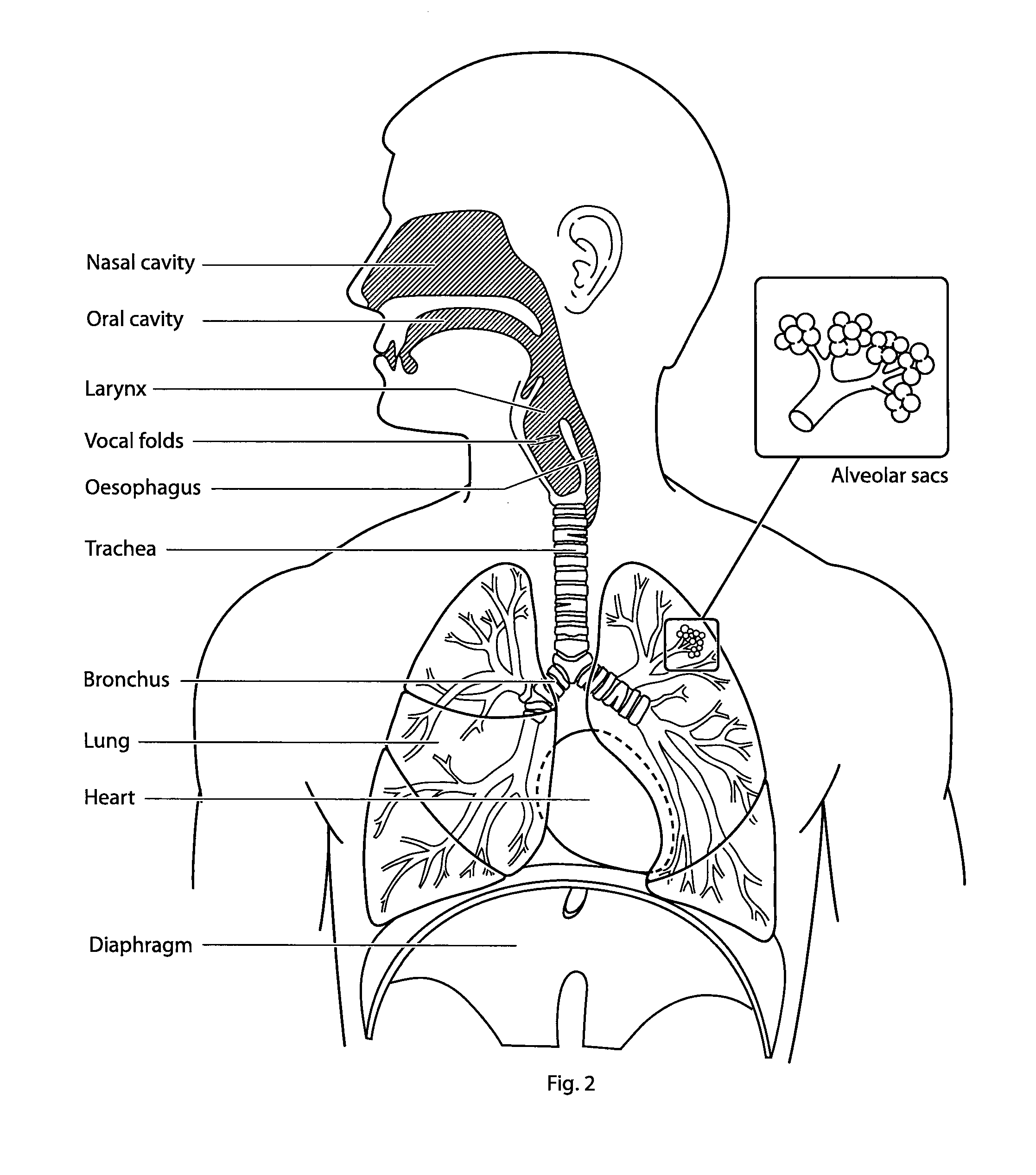 Breathing assistance system with speech detection