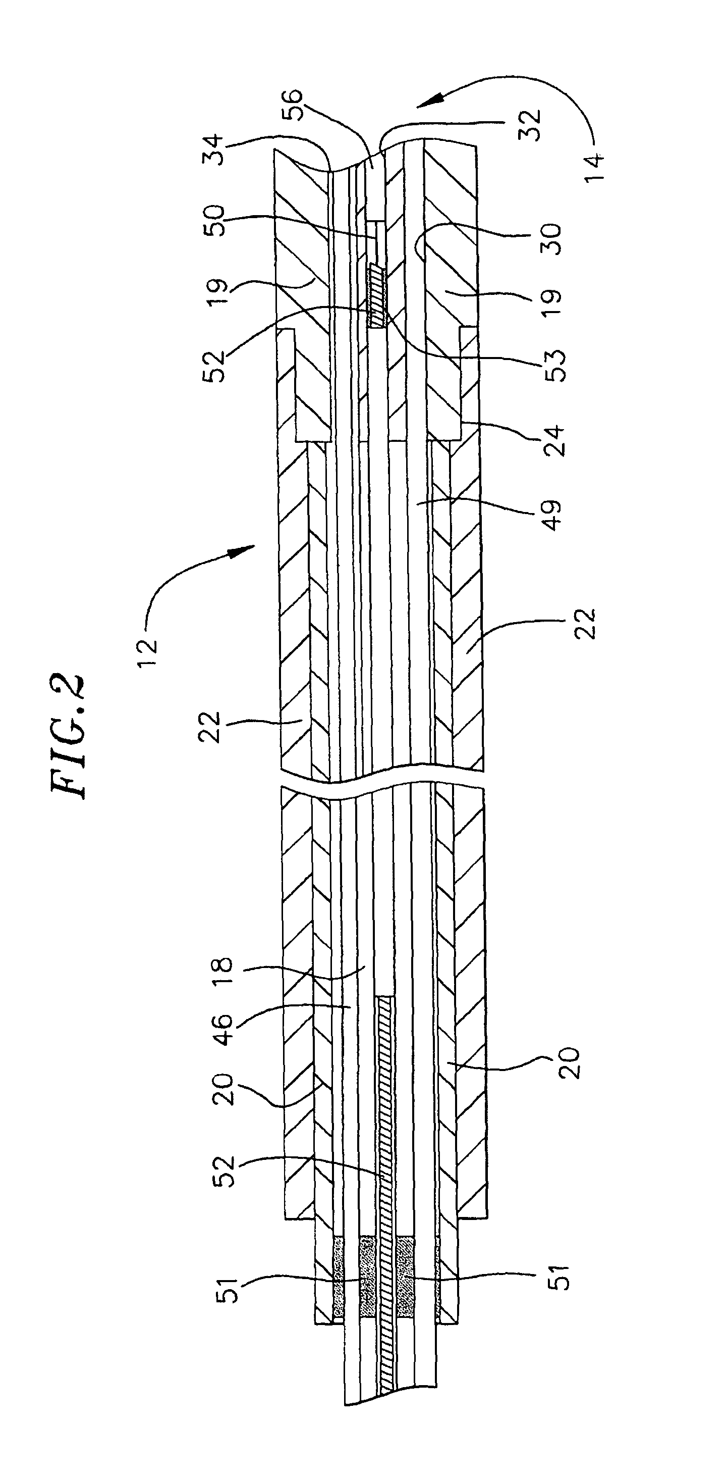 Irrigated catheter having a porous tip electrode