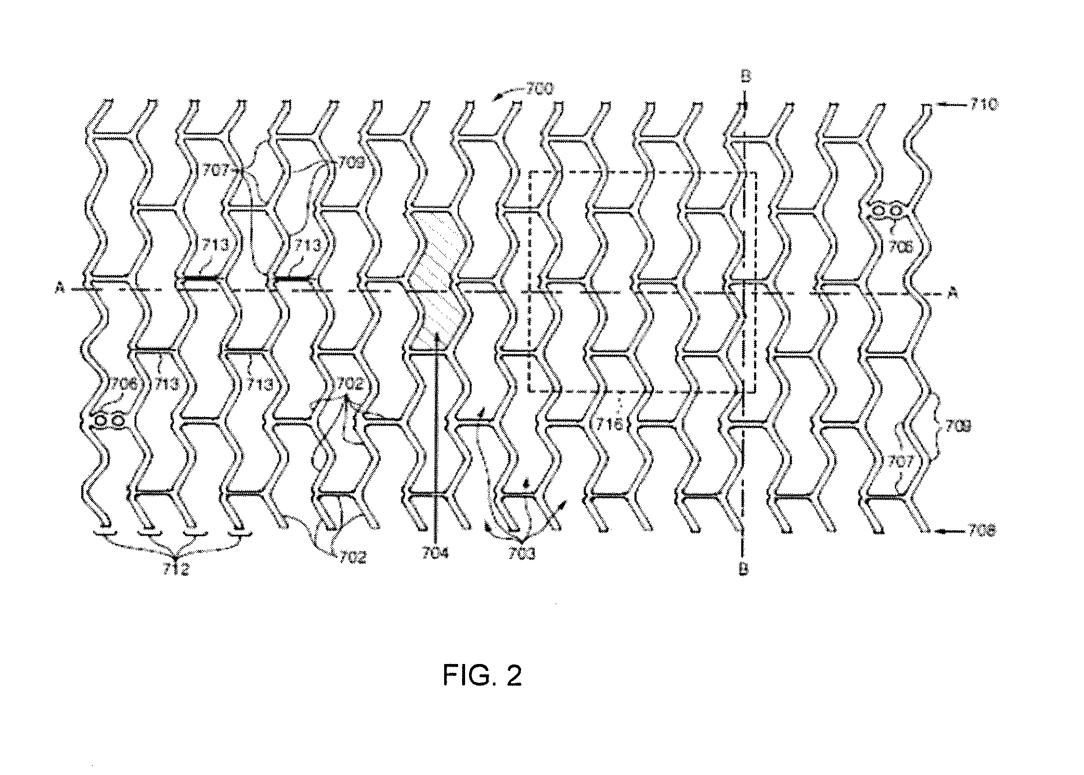 Pediatric application of bioabsorbable polymer stents in infants and children with congenital heart defects