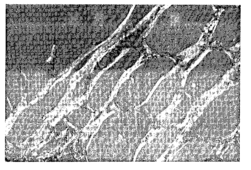 Method for preparing medical III type collagen