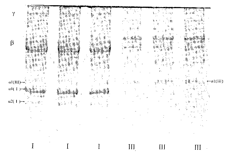 Method for preparing medical III type collagen