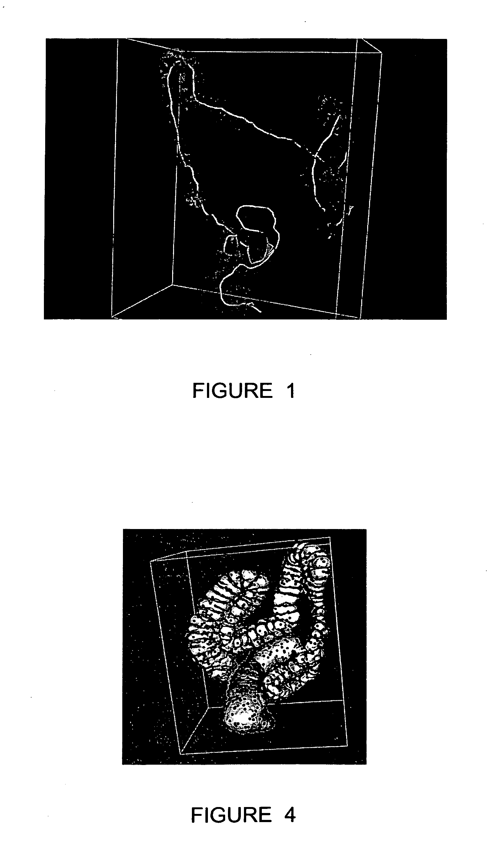 Method and apparatus for registration of virtual endoscopic images