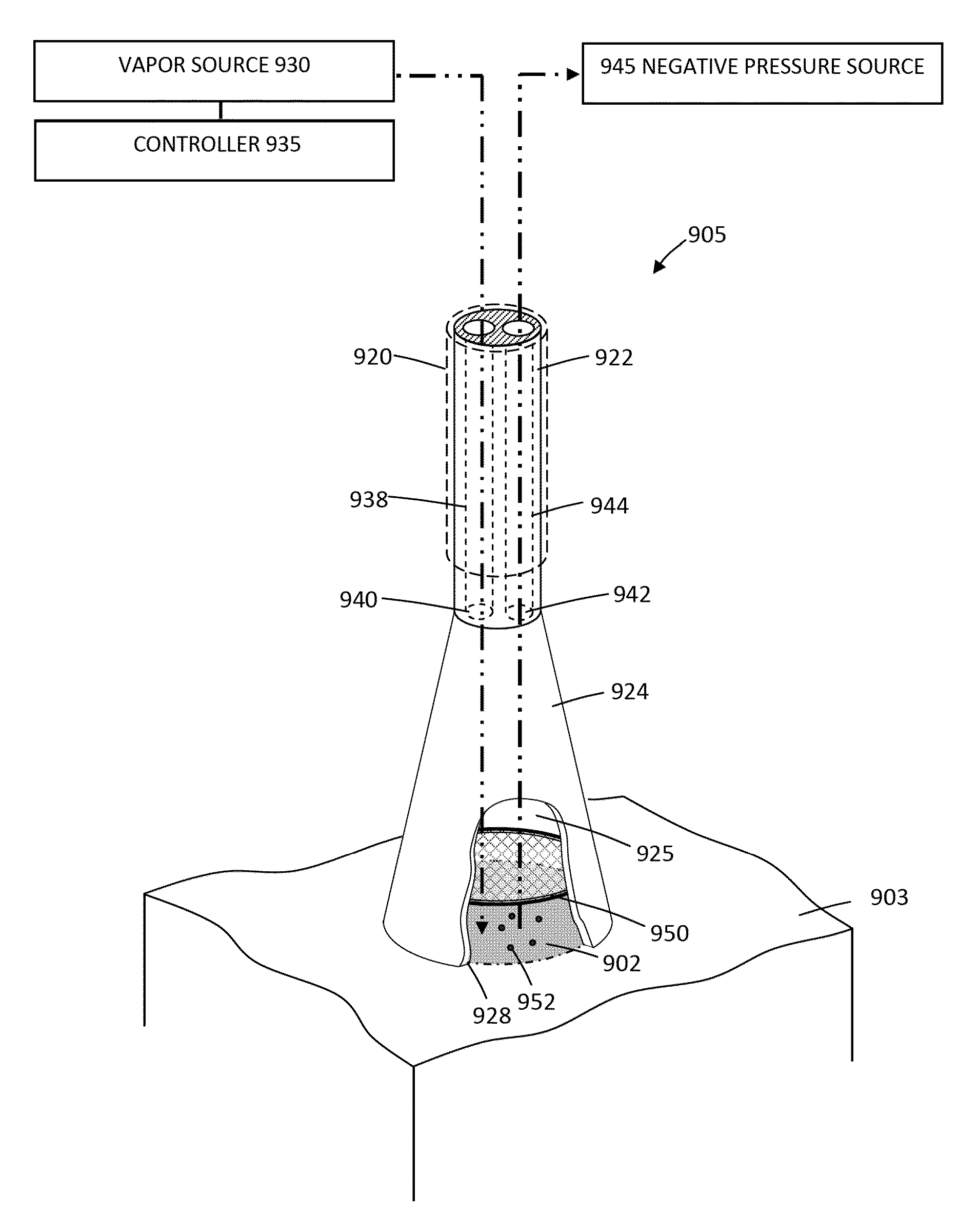 Medical system and method of use