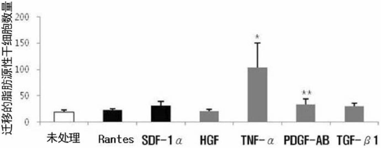 Method for inducing migration of adult stem cells derived from adipose tissue