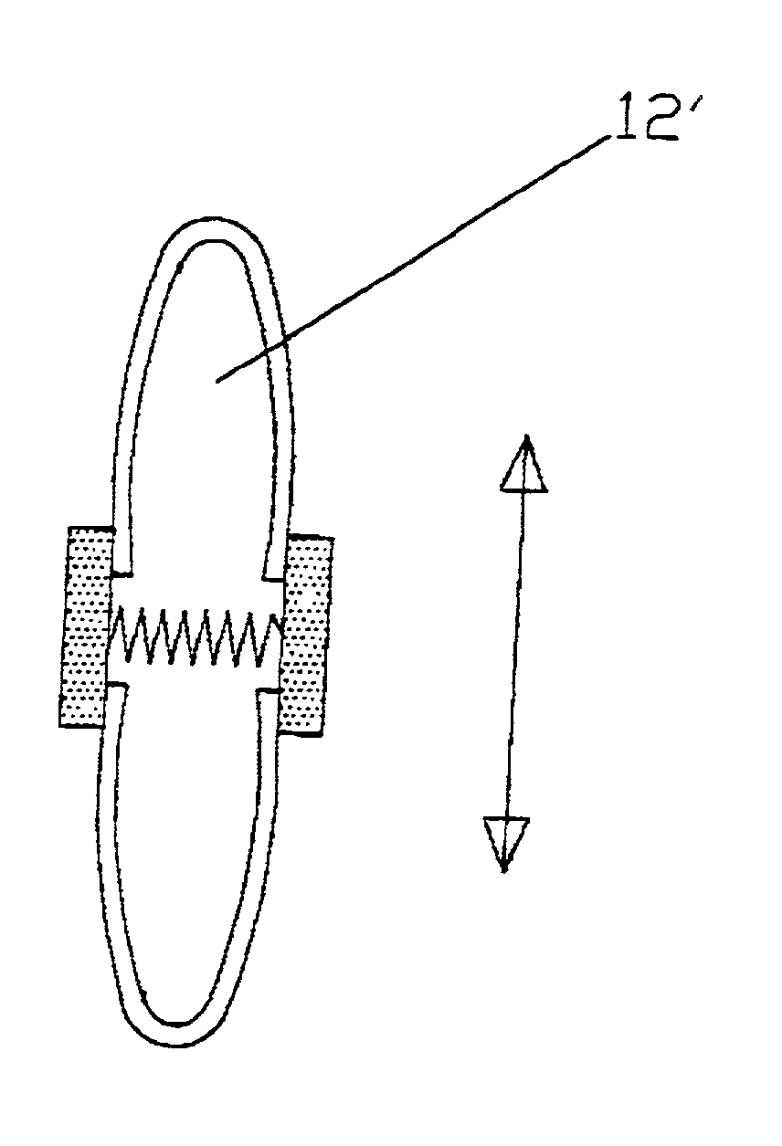 Accommodating zonular mini-bridge implants