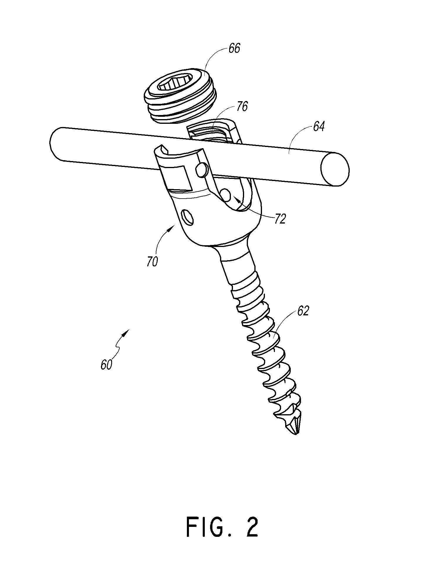 Minimally invasive devices, systems and methods for treating the spine