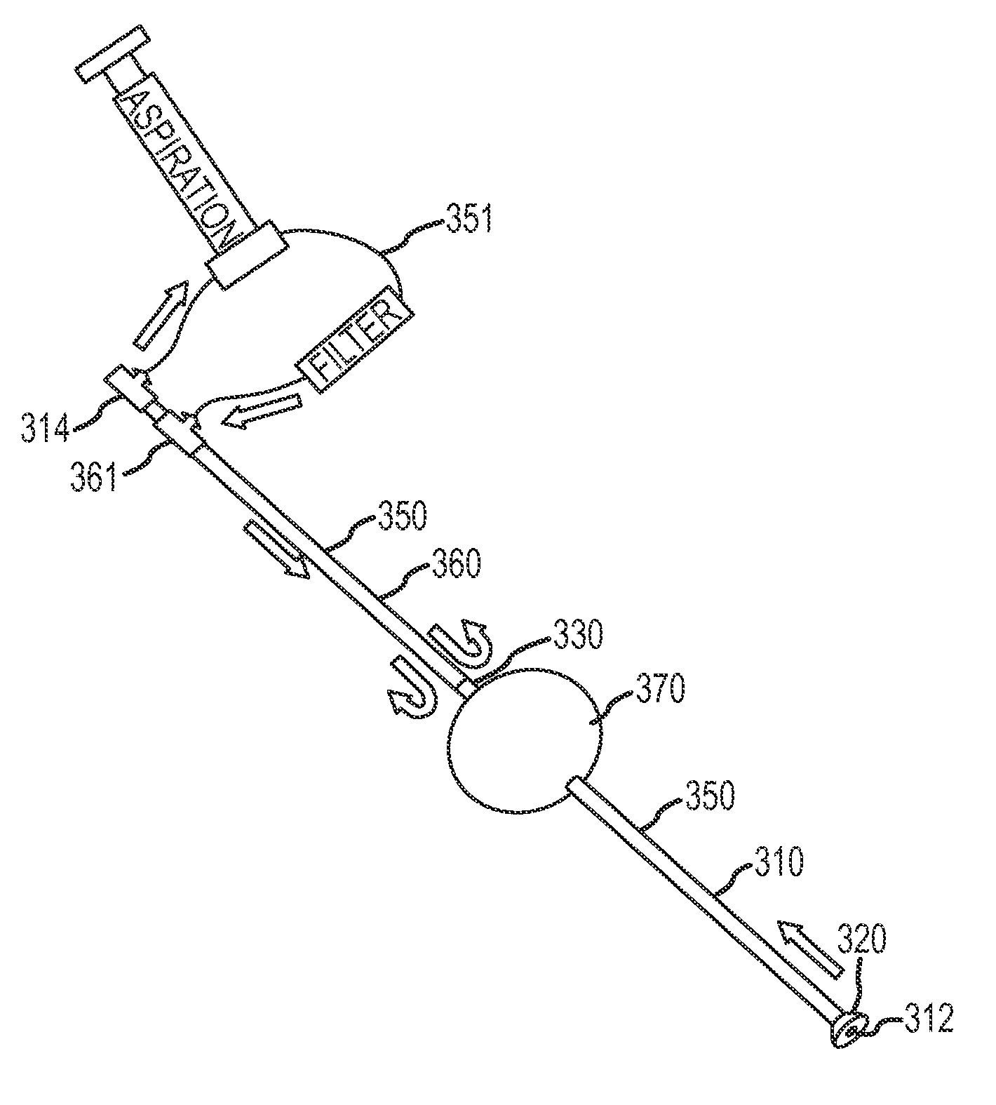 Single access flow-reversal catheter devices and methods