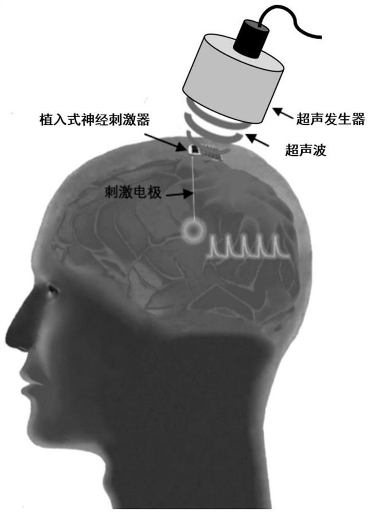 Battery-free flexible implantable deep brain stimulator, battery-free flexible implantable deep brain stimulator system and preparation method