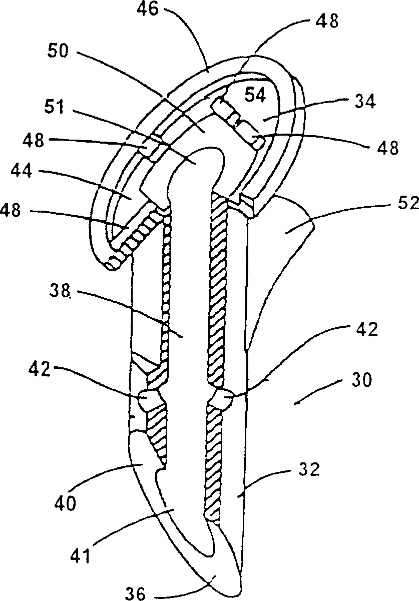 Intraocular implant, delivery device, and method of implantation