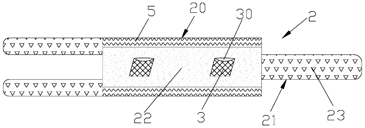 PICC duct outer fixing sleeve