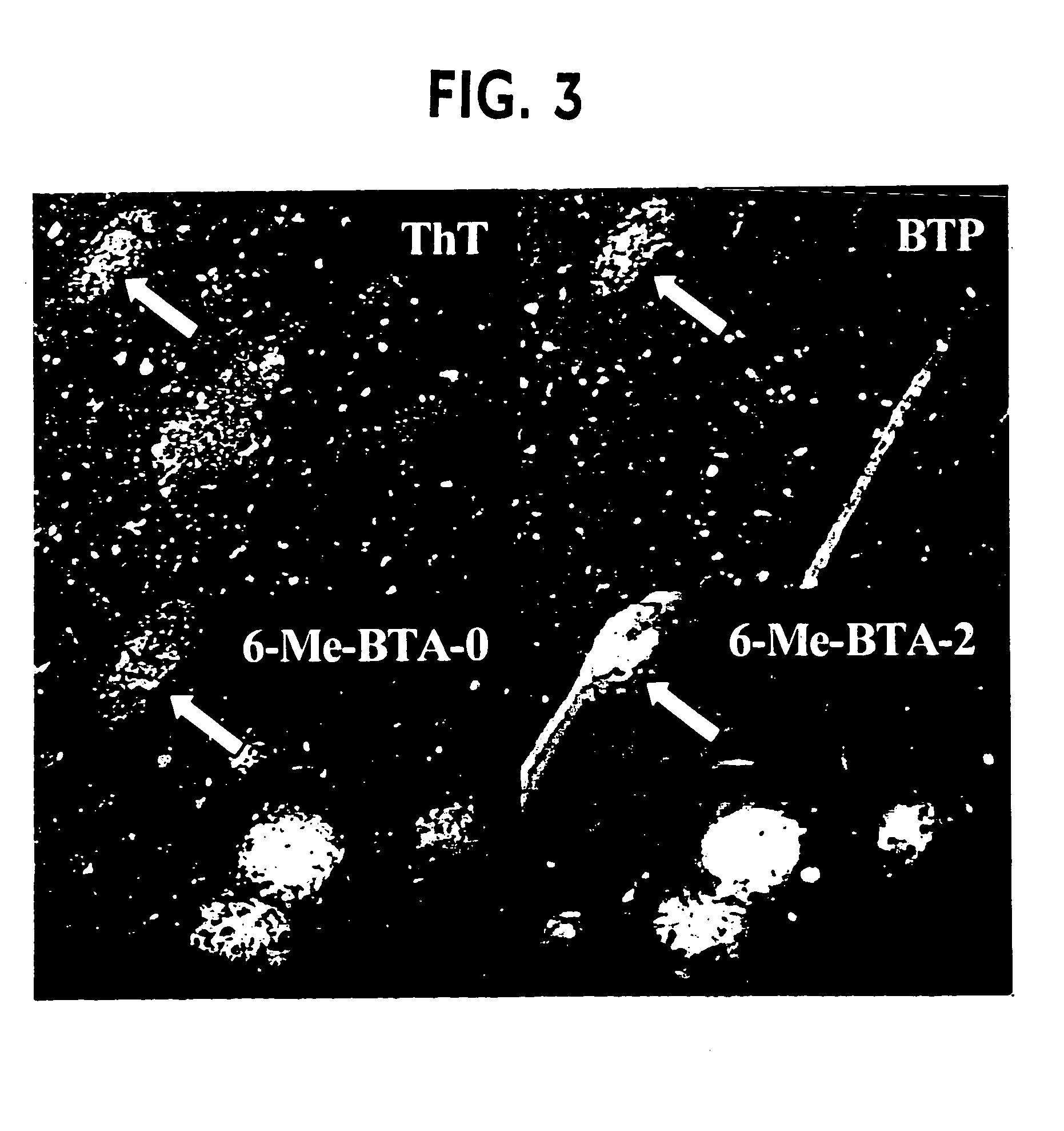 Thioflavin derivatives for use in the antemortem diagnosis of alzheimers disease and in vivo imaging and prevention of amyloid deposition