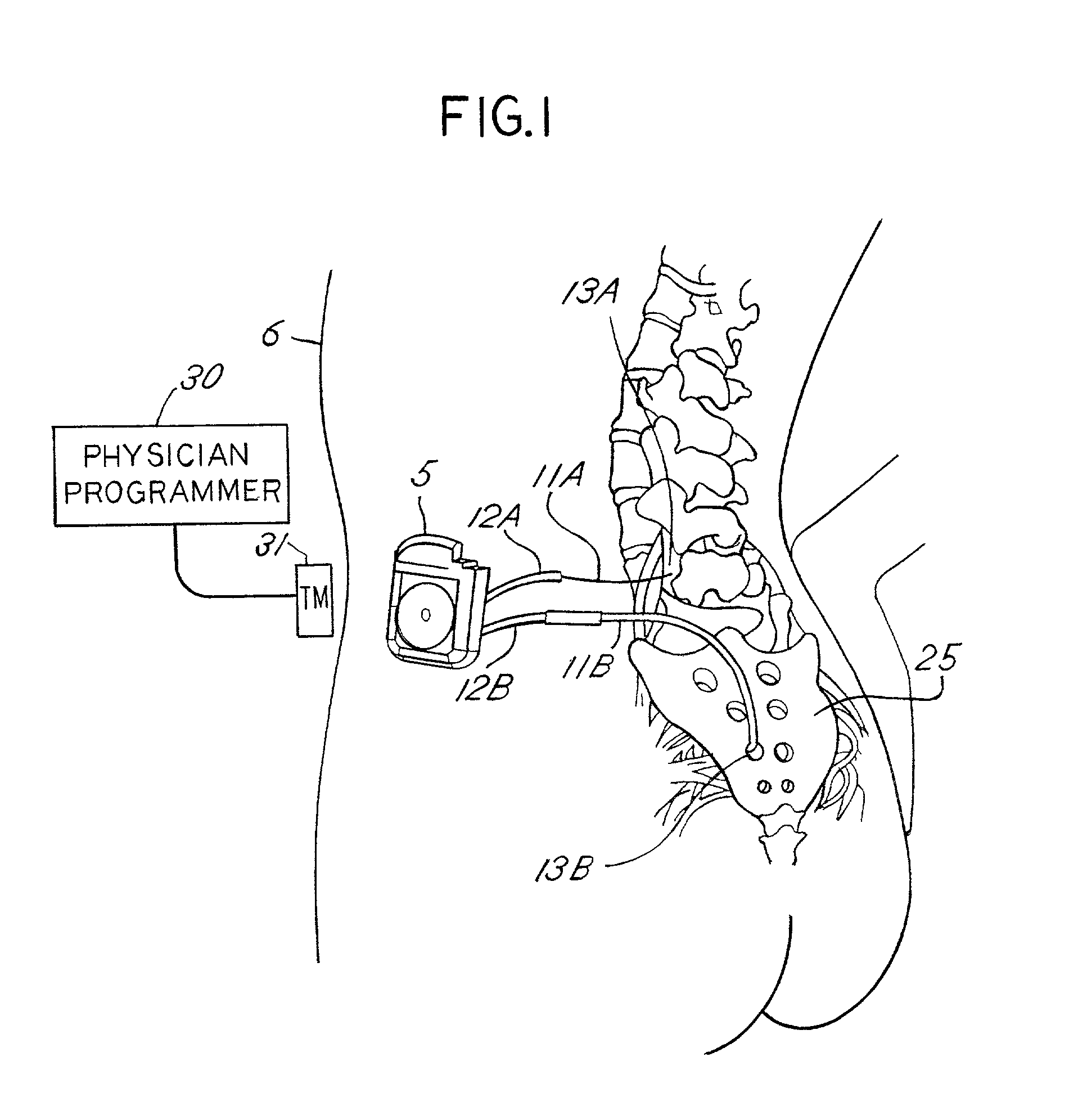 Telemetry module with configurable data layer for use with an implantable medical device