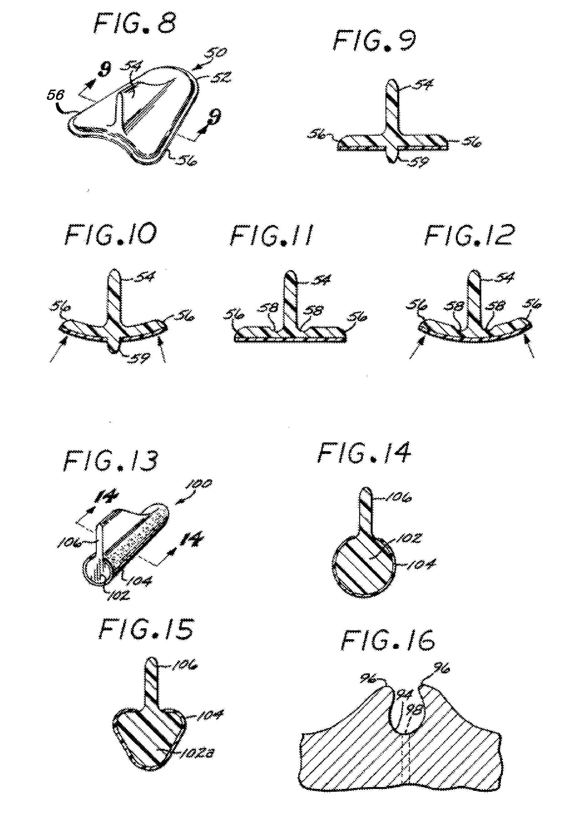 Systems and methods for incontinence control