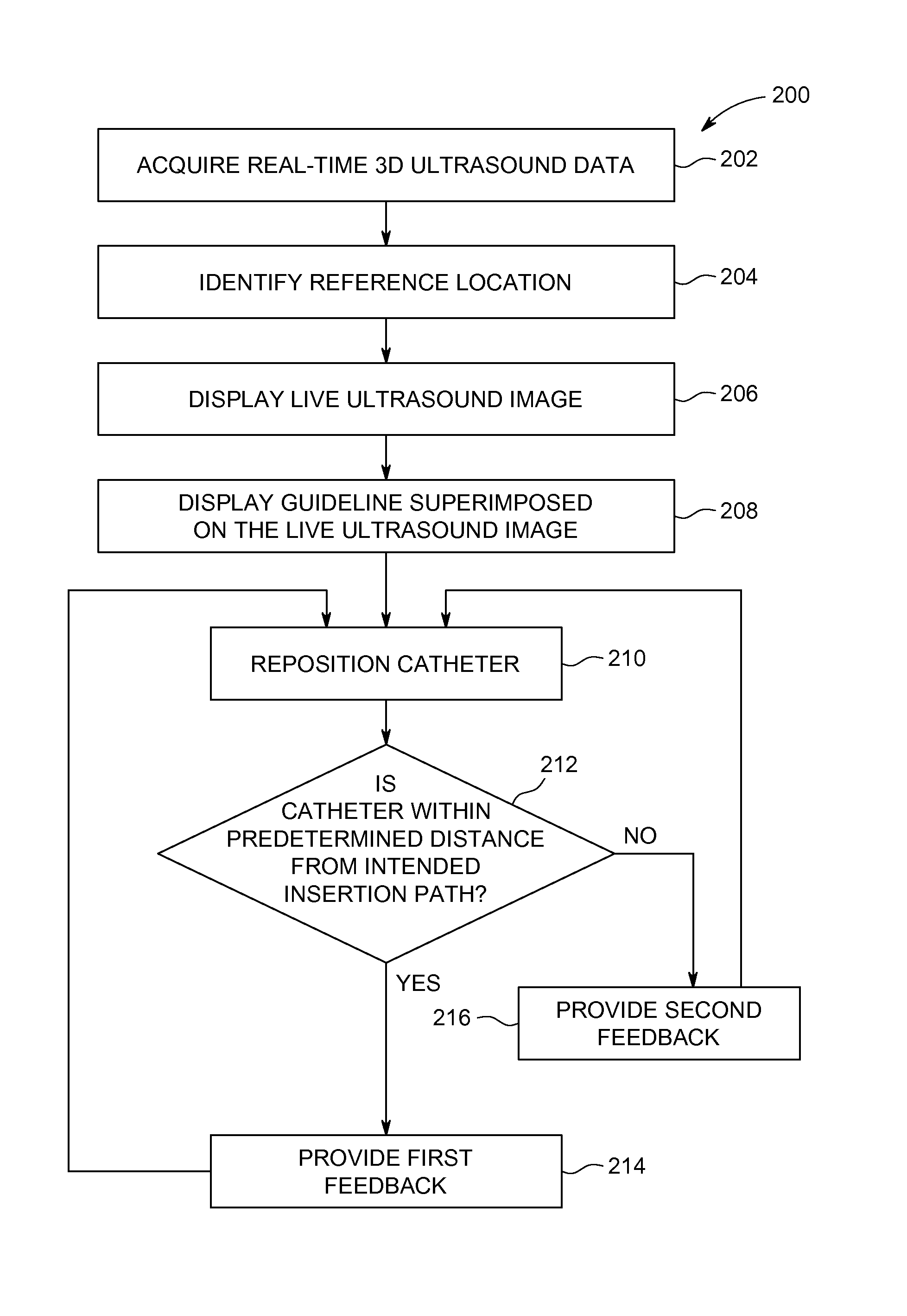 Ultrasound imaging system and ultrasound-based method for guiding a catheter