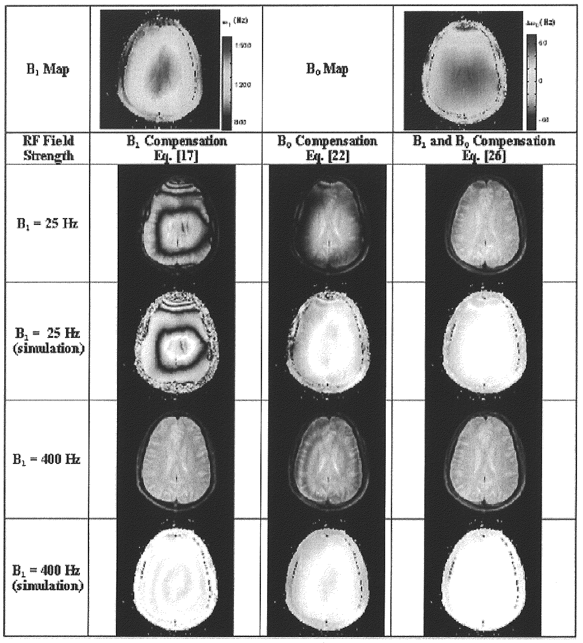 Reducing imaging-scan times for MRI systems