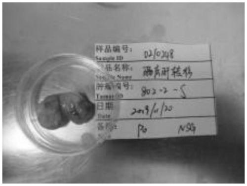 Construction method of human-derived tumor xenograft model