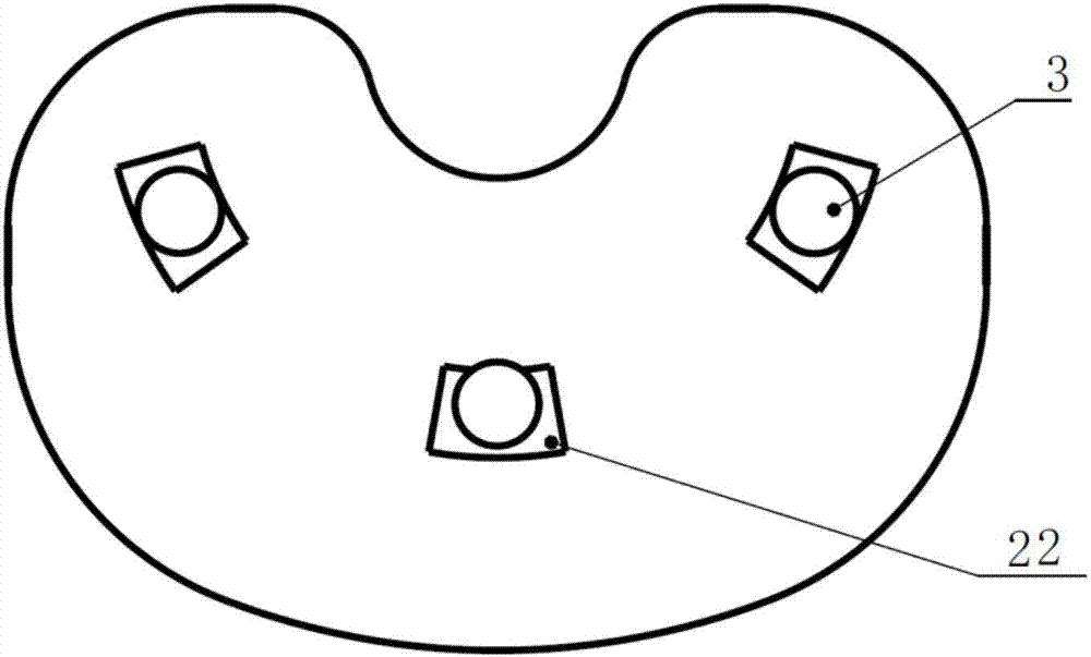 Rotation platform knee joint prosthesis