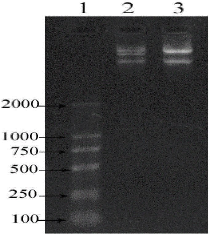 Recombined Tbeta 4-BP5 fusion peptide, gene, engineering bacteria and application