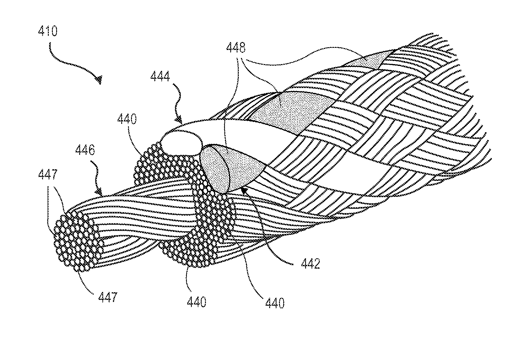 Colored Suture Construction