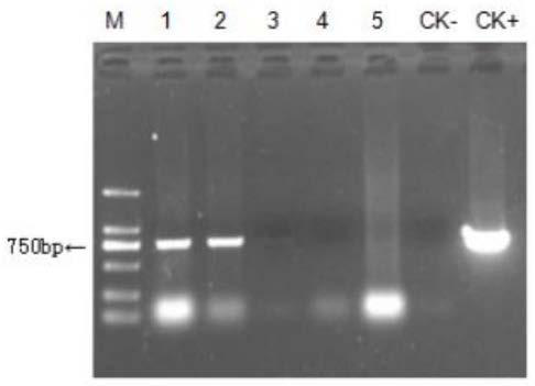 Rubber tree embryoid body induction medium, method for inducing embryogenic callus and method for cultivating resistant callus