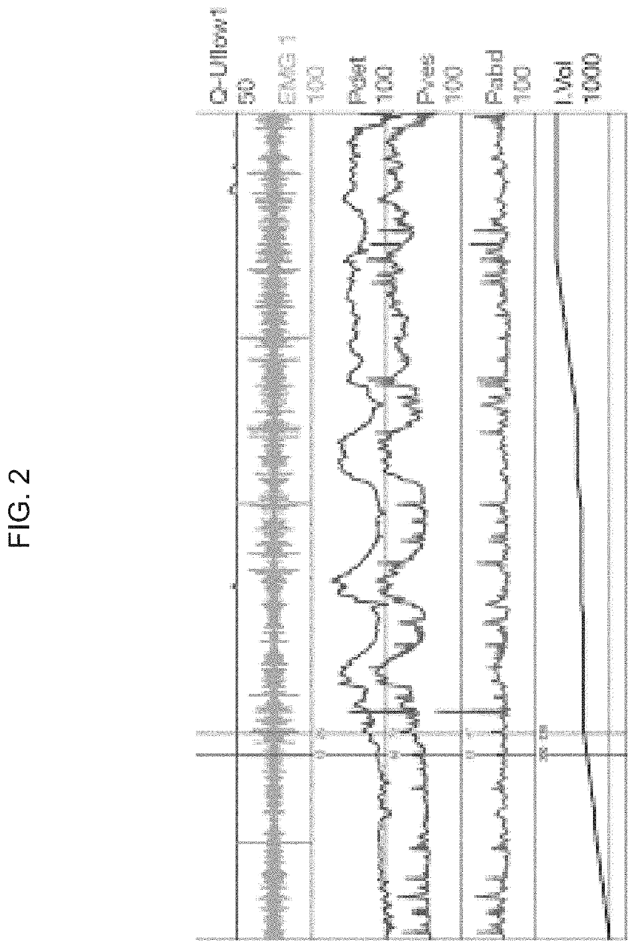 Devices, systems, and methods for monitoring bladder function