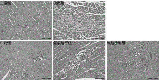 Traditional Chinese medicine composition for controlling hypertension and protecting hypertension target organ against damage and application thereof