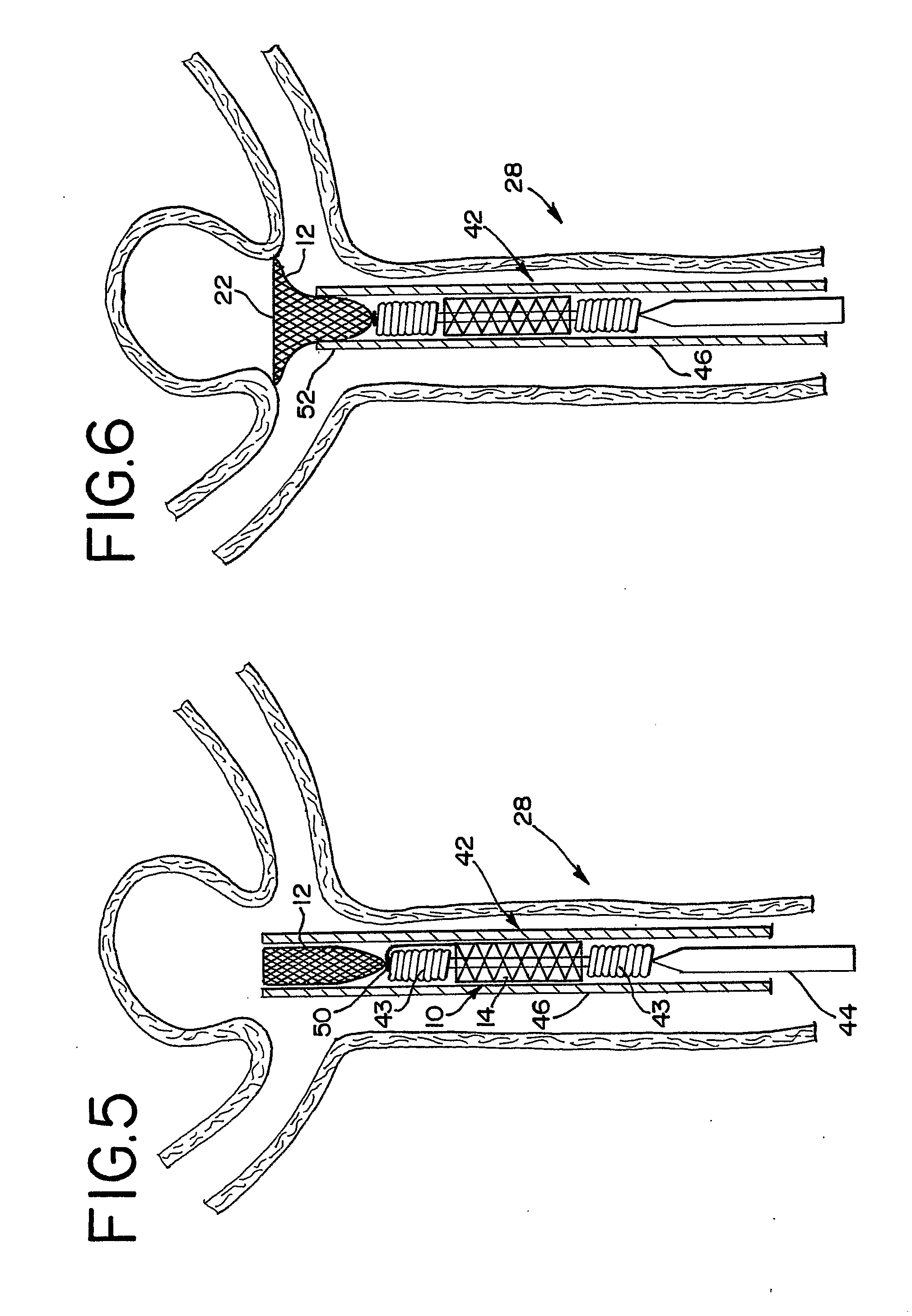 Thin Film Metallic Devices for Plugging Aneurysms or Vessels