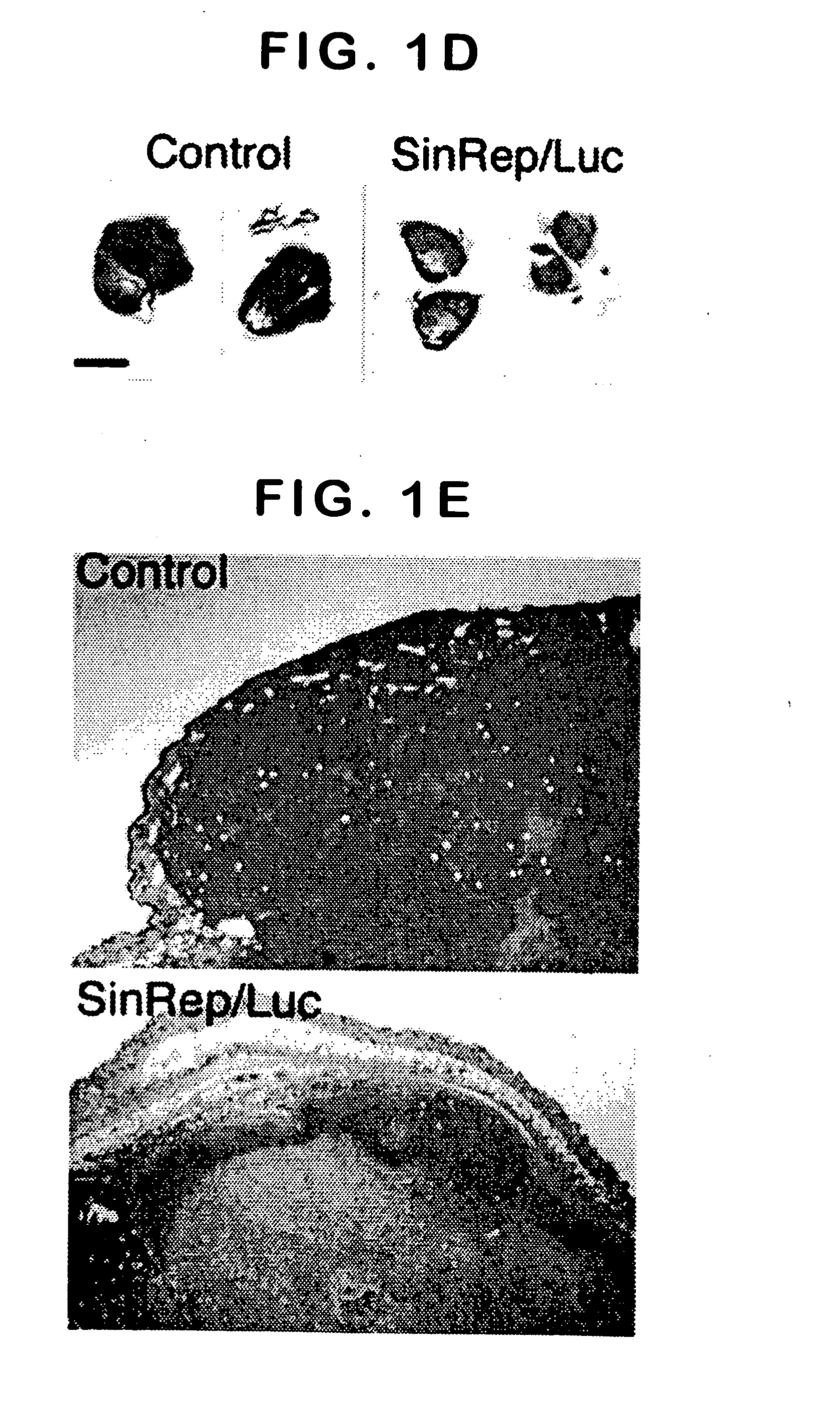 Method for detecting cancer cells and monitoring cancer therapy