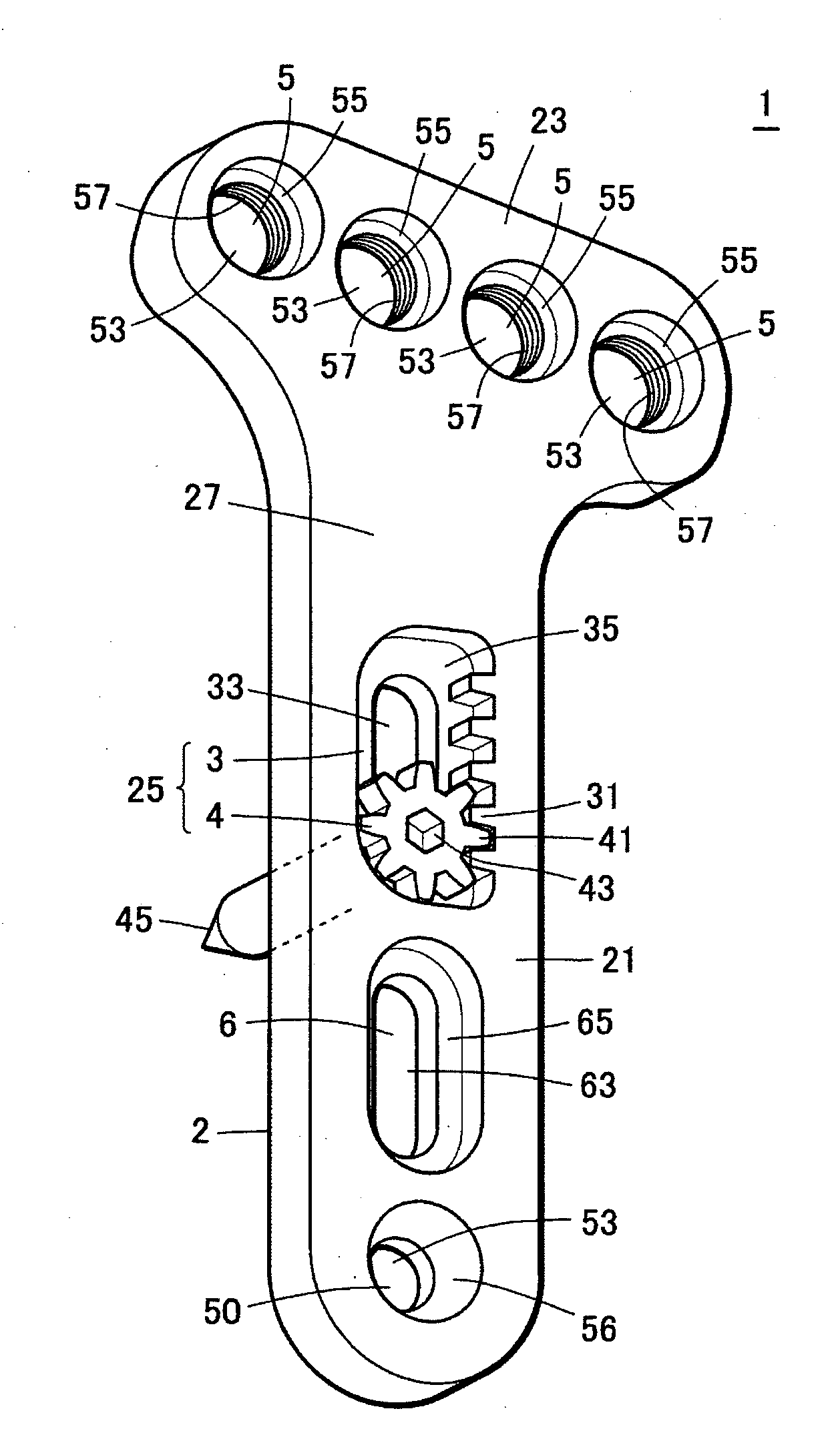 Mechanism for Osteosynthesis