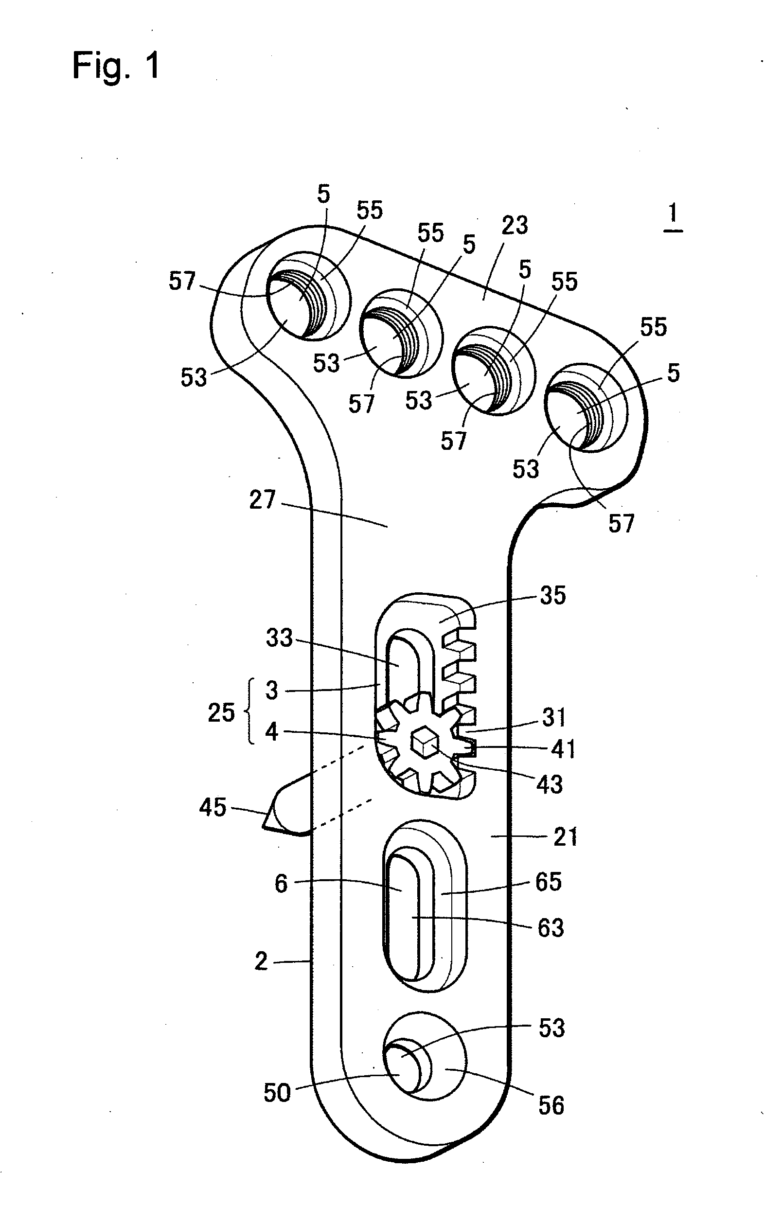 Mechanism for Osteosynthesis