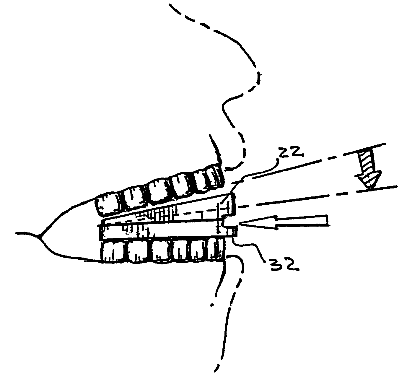 Mouthpiece for reducing snoring