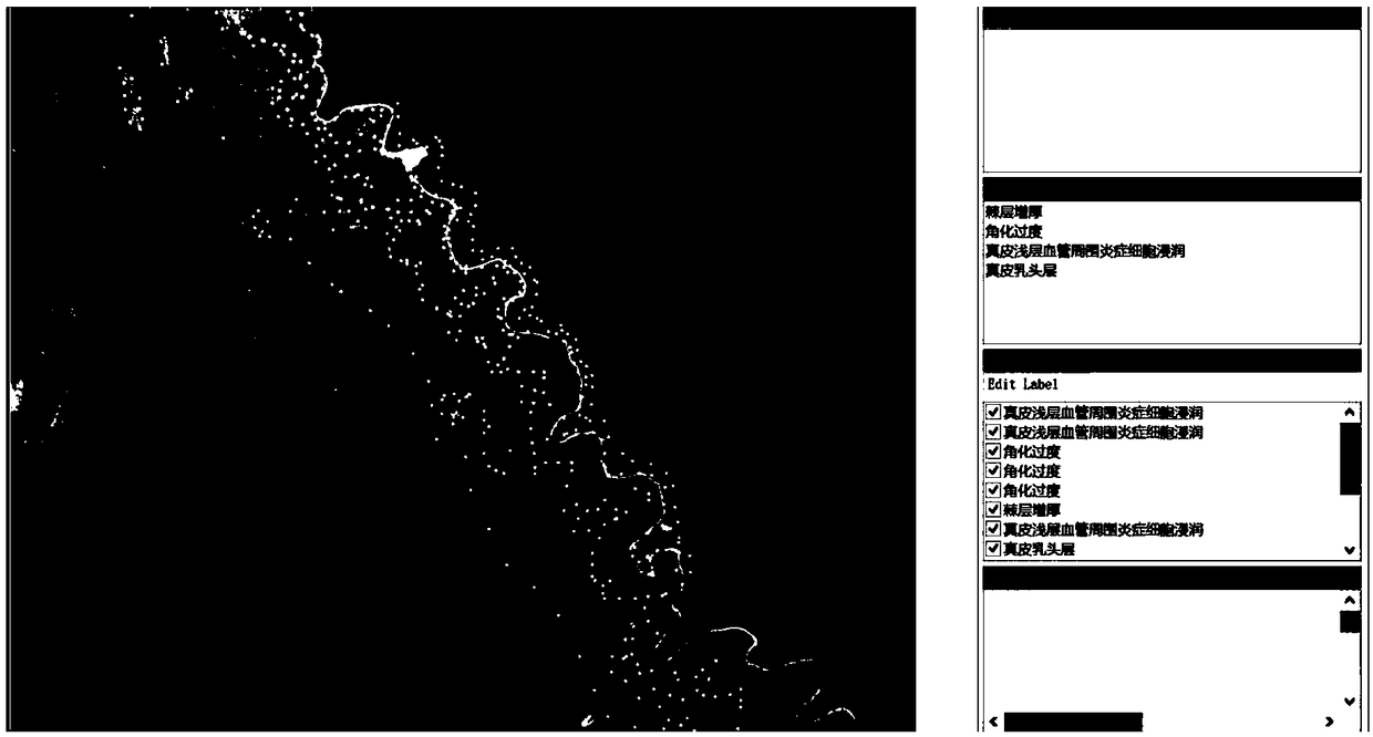 Recognition method and system based on dermatopathology images